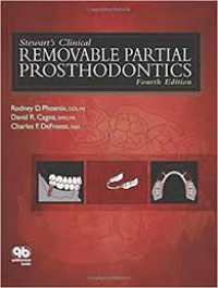 Stewart's Clinical Removable Partial Prosthodontics, 4th. Ed