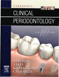 Carranza's Clinical Periodontology, 10th ed.