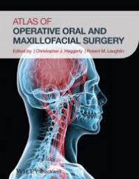 Atlas of Operative Oral And Maxillofacial Surgery, 1st. Ed