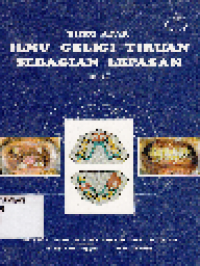 Buku Ajar Ilmu Geligi Tiruan sebagai Lepasan