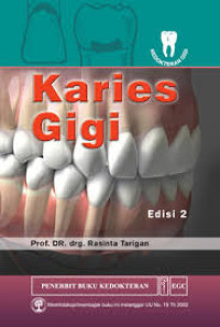 Karies Gigi, Ed. 2