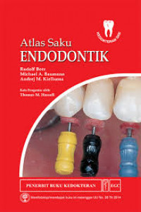 Atlas Saku Endodontik