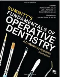 Summitt's Fundamentals of Operative Dentistry: A Contemporary Approach, 4th. Ed