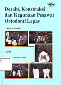Image of Desain, konstruksi dan kegunaan pesawat ortodonsi lepas