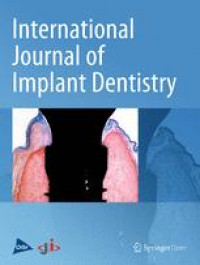 INTERNATIONAL JOURNAL OF IMPLANT DENTISTRY VOL.1 2015