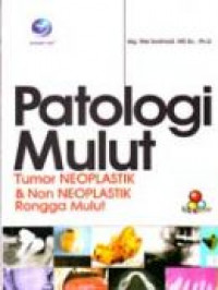 Patologi Mulut Tumor Neoplastik & Non Neoplastik Rongga Mulut