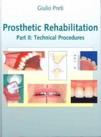 Image of Prosthetic Rehabilitation