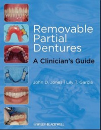 Removable Partial Dentures: A Clinician's Guide