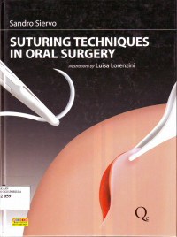 Suturing Techniques in oral surgery