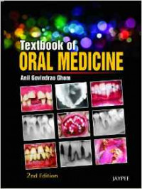 Textbook Of Oral Medicine, 2E