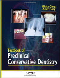 Textbook of Preclinical Conservative Dentistry