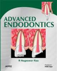 Advance Endodontics, 1st. Ed