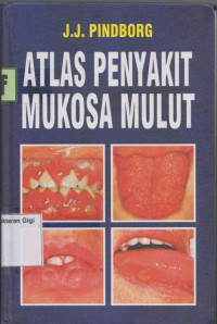 Image of Atlas Penyakit Mukosa Mulut