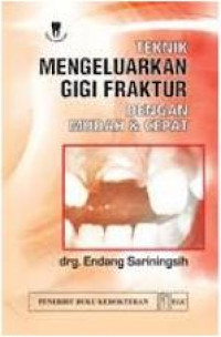 Image of Teknik mengeluarkan gigi fraktur dengan mudah & cepat
