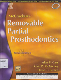 Mc. Cracken's Removable Partial Prosthodontics, 11th. Ed