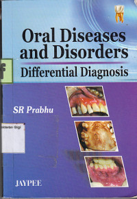 Oral Diseases and Disorders : Differentials Diagnosis