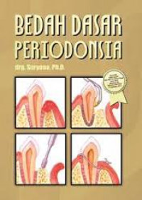 Bedah Dasar Periodonsia