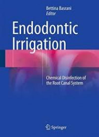 Image of Endodontic Irrigation: Chemical Disinfection of The Root Canal System
