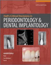 Image of Hall's Critical Decisions in Periodontology and Dental Implantology, 5th. Ed