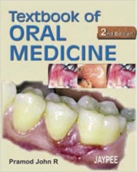 Textbook Of Oral Medicine, 2E