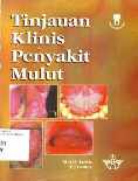 Tinjauan Klinis Penyakit mulut; Clinical Oral Medicine