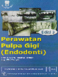 Perawatan Pulpa Gigi (Endodonti)